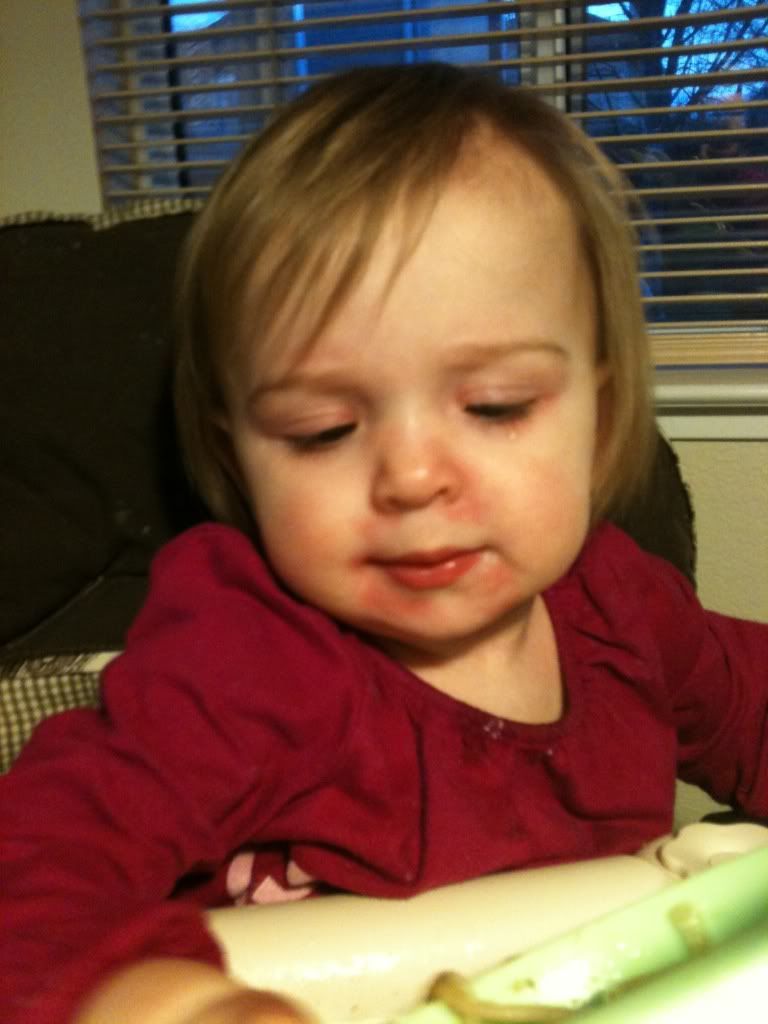 Kiwi allergy?? BabyCenter