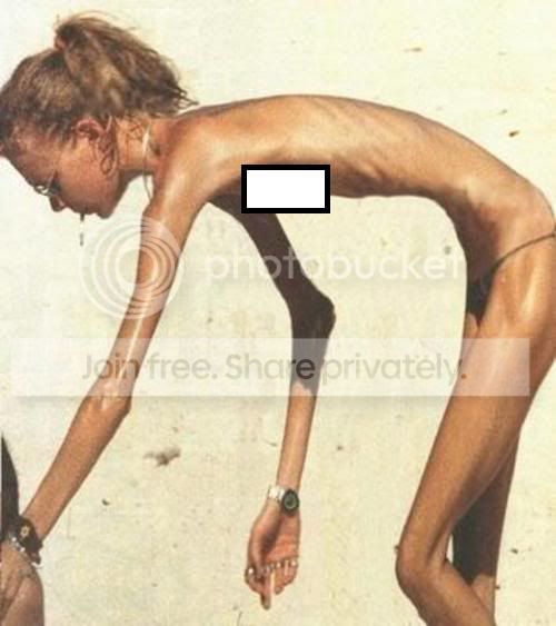 SkinnyGirl.jpg